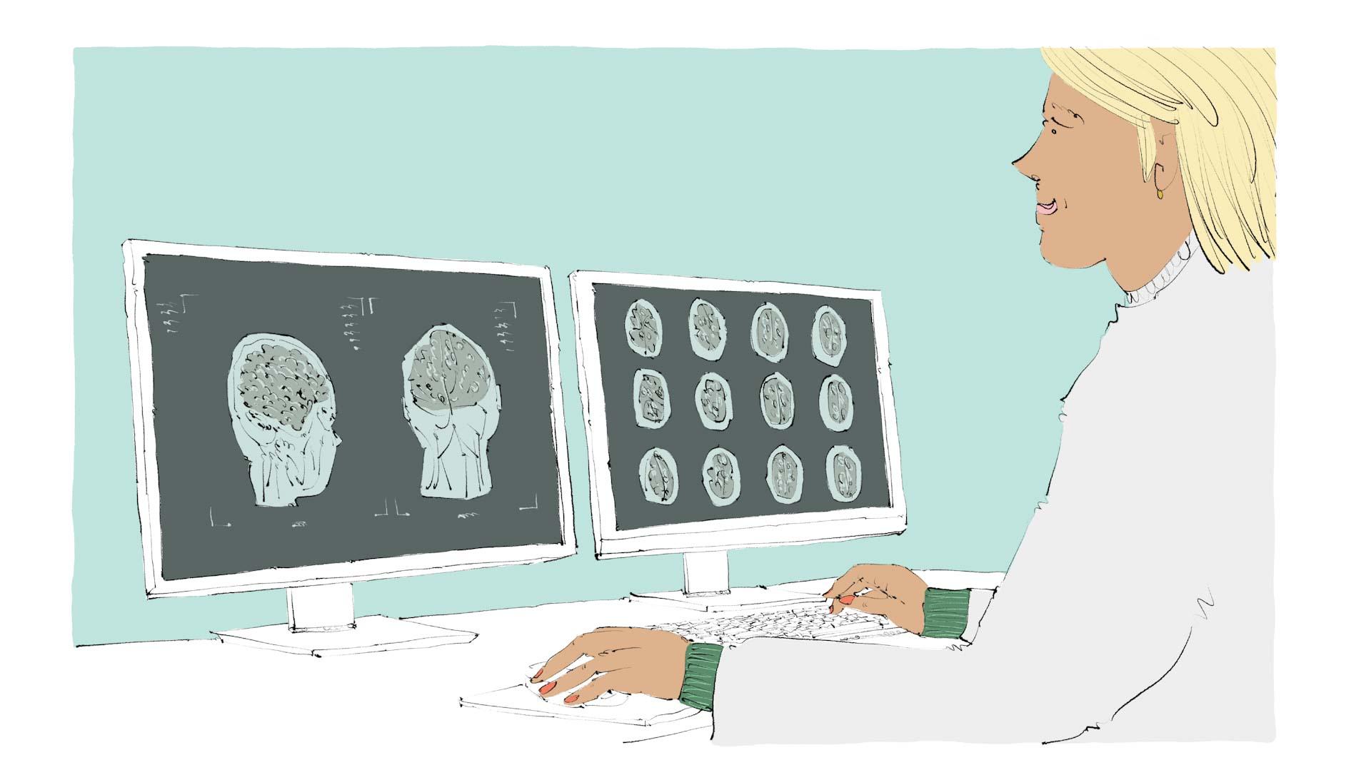 Woman examining brain scans on two computer monitors, illustration